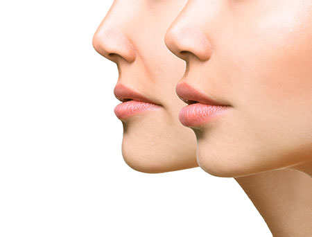 lips 2